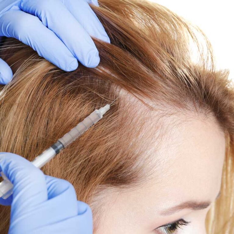 Hair Loss Treatment in Isle of Man | Dr. Ram Aesthetics
